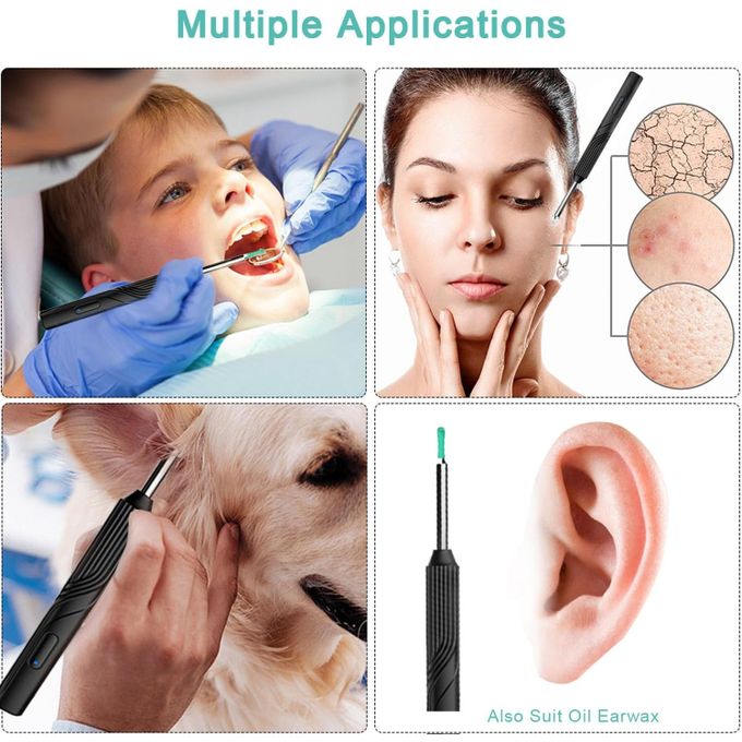 Auricam™ - Nettoyeur d'oreille intelligent avec caméra HD