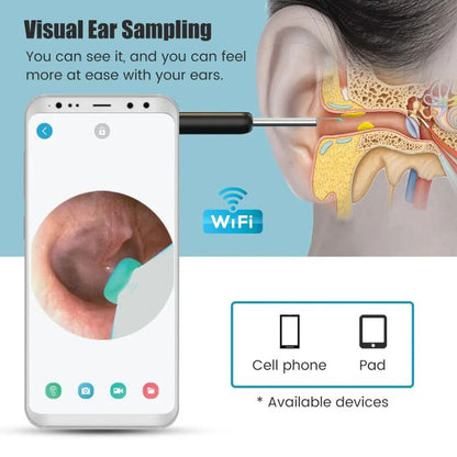 Auricam™ - Nettoyeur d'oreille intelligent avec caméra HD