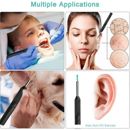 Auricam™ - Nettoyeur d'oreille intelligent avec caméra HD