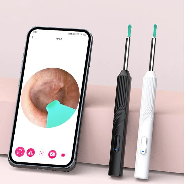 Auricam™ - Nettoyeur d'oreille intelligent avec caméra HD